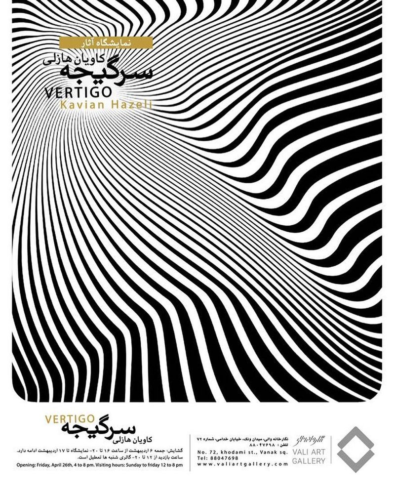 سرگیجه