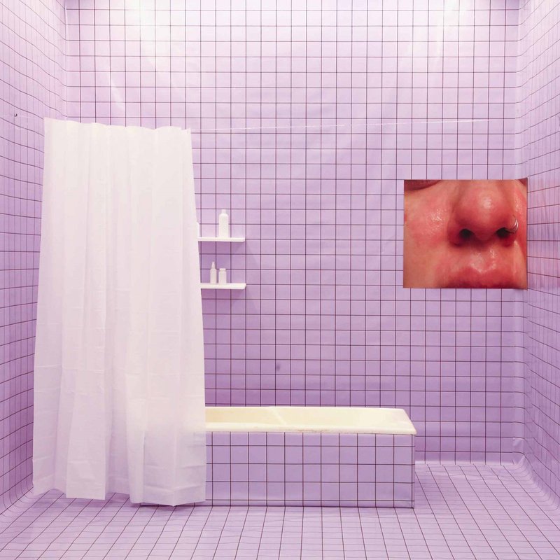 Hypersensitivity